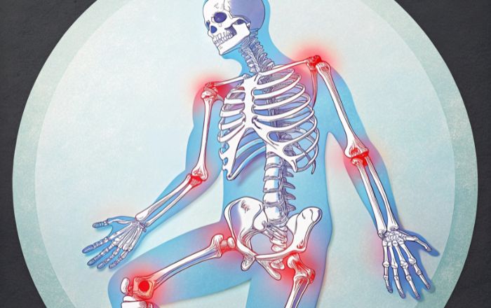 Joint Pain Treatment