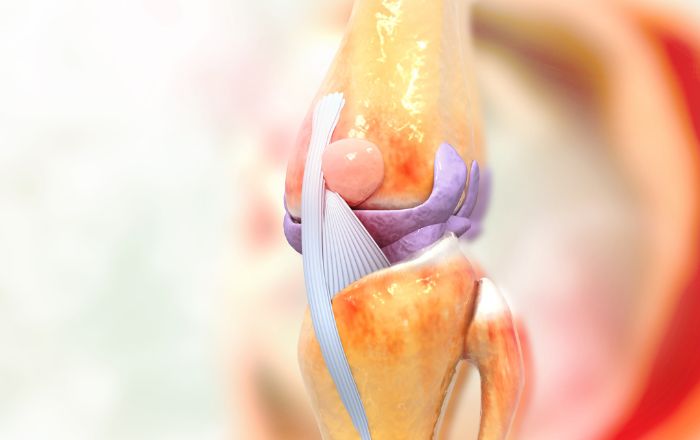 Joint Replacement